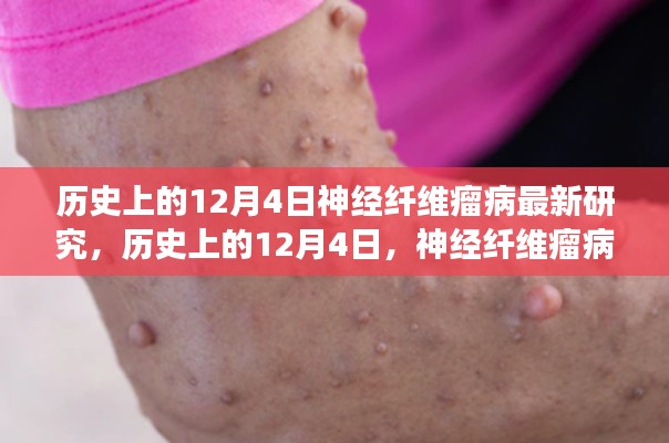 歷史上的神經(jīng)纖維瘤病研究之旅，與自然美景共舞，探尋內(nèi)心寧靜港灣的新突破