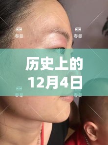 革命性雀斑最新技術誕生，重塑美顏新紀元，歷史上的十二月四日里程碑式突破