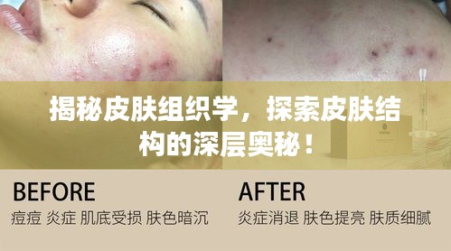 揭秘皮膚組織學，探索皮膚結(jié)構(gòu)的深層奧秘！