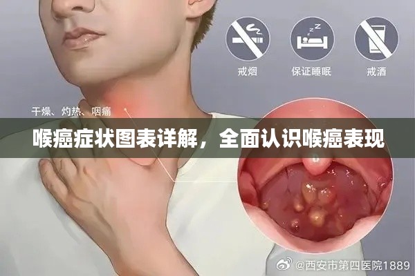 喉癌癥狀圖表詳解，全面認識喉癌表現