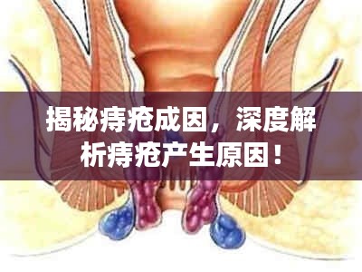 揭秘痔瘡成因，深度解析痔瘡產(chǎn)生原因！