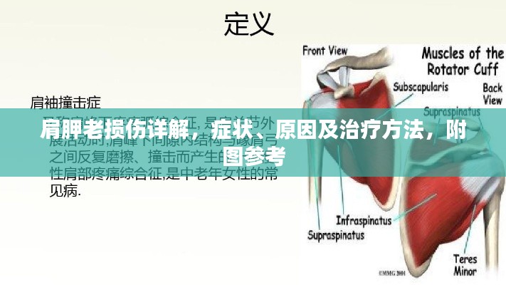 肩胛老損傷詳解，癥狀、原因及治療方法，附圖參考