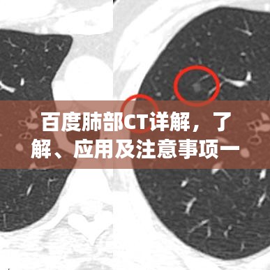 百度肺部CT詳解，了解、應用及注意事項一網打盡