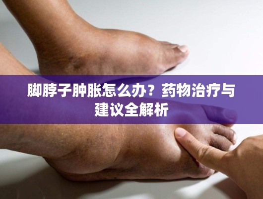 腳脖子腫脹怎么辦？藥物治療與建議全解析