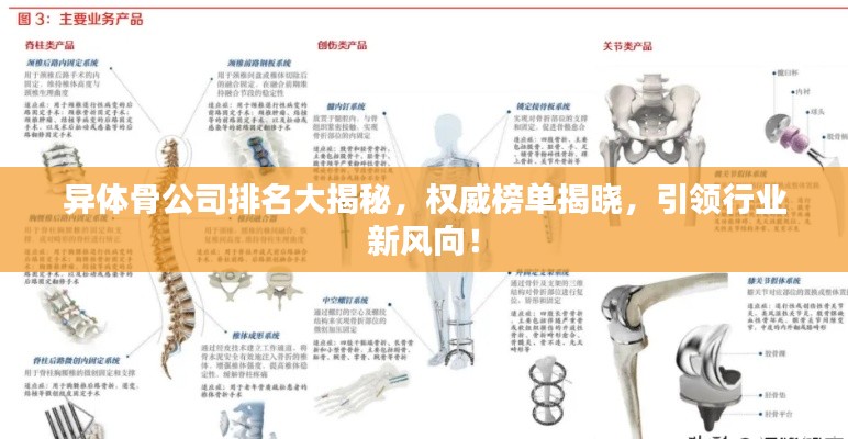 異體骨公司排名大揭秘，權(quán)威榜單揭曉，引領(lǐng)行業(yè)新風(fēng)向！